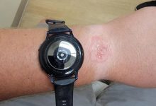 Фото - Опасные технологии: пользователь получил ожог от умных часов Samsung Galaxy Watch