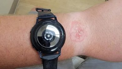Фото - Опасные технологии: пользователь получил ожог от умных часов Samsung Galaxy Watch